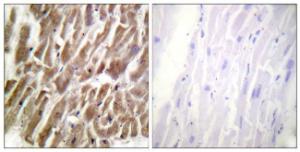 Immunohistochemical analysis of paraffin-embedded human heart tissue using Anti-TNNI3 Antibody. The right hand panel represents a negative control, where the antibody was pre-incubated with the immunising peptide.