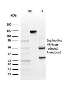 SDS-PAGE analysis of Anti-INSM2 Antibody [INSM2/4291] under non-reduced and reduced conditions; showing intact IgG and intact heavy and light chains, respectively. SDS-PAGE analysis confirms the integrity and purity of the antibody