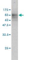 Anti-SQSTM1 Mouse Monoclonal Antibody [clone: 2C11]