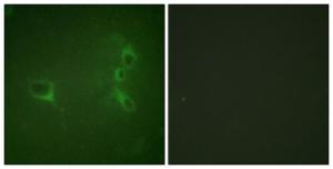 Immunofluorescence analysis of NIH/3T3 cells using Anti-Bcr (phospho Tyr360) Antibody. The right hand panel represents a negative control, where the antibody was pre-incubated with the immunising peptide