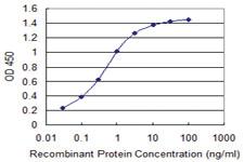 Anti-IDH2 Mouse Monoclonal Antibody [clone: 2G10]