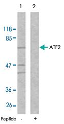 Anti-ATF2 Rabbit Polyclonal Antibody