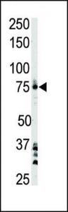 Anti-BTK Rabbit Polyclonal Antibody (AP (Alkaline Phosphatase))