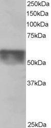 Anti-KPNA4 Antibody (A84001) staining (0.5µg/ml) of Human Testis lysate (RIPA buffer, 35µg total protein per lane). Primary incubated for 1 hour. Detected by chemiluminescence.