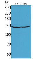 Western blot analysis of 4T 293 cells using Anti-ITGAD Antibody