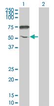 Anti-ENPP5 Mouse Monoclonal Antibody [clone: 1C5-1D7]