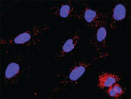 Anti-STAT4 Antibody Pair