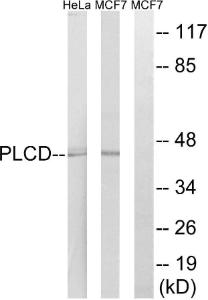 Western blot analysis of lysates from HeLa and MCF-7 cells using Anti-AGPAT4 Antibody. The right hand lane represents a negative control, where the antibody is blocked by the immunising peptide