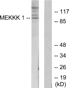 Western blot analysis of lysates from HepG2 cells using Anti-MEKKK 1 Antibody. The right hand lane represents a negative control, where the antibody is blocked by the immunising peptide