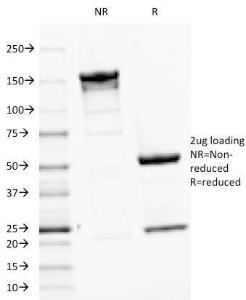 SDS-PAGE analysis of Anti-Parathyroid Hormone Antibody [PTH/1175] under non-reduced and reduced conditions; showing intact IgG and intact heavy and light chains, respectively. SDS-PAGE analysis confirms the integrity and purity of the antibody