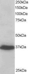 Anti-PDLIM4 Antibody (A84002) staining (0.2 µg/ml) of A431 lysate (RIPA buffer, 35 µg total protein per lane). Primary incubated for 1 hour. Detected by chemilu minescence