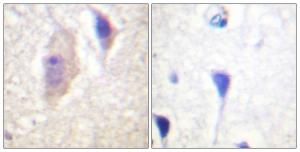 Immunohistochemical analysis of paraffin-embedded human brain using Anti-Bcr (phospho Tyr360) Antibody. The right hand panel represents a negative control, where the antibody was pre-incubated with the immunising peptide