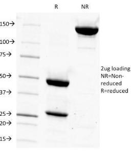 SDS-PAGE analysis of Anti-Prostate Specific Antigen Antibody [1A7] under non-reduced and reduced conditions; showing intact IgG and intact heavy and light chains, respectively. SDS-PAGE analysis confirms the integrity and purity of the antibody