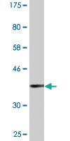 Anti-B3GAT3 Mouse Monoclonal Antibody [clone: 1C11]