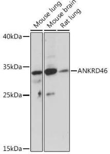 Western blot analysis of extracts of various cell lines, using Anti-ANKRD46 Antibody (A307895) at 1:1,000 dilution