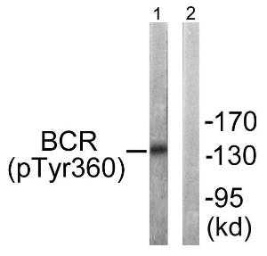 Western blot analysis of lysates from COS7 cells using Anti-Bcr (phospho Tyr360) Antibody. The right hand lane represents a negative control, where the antibody is blocked by the immunising peptide