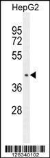 Anti-CCDC17 Rabbit Polyclonal Antibody (AP (Alkaline Phosphatase))