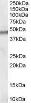 Anti-STK35 antibody