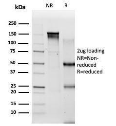 SDS-PAGE analysis of Anti-PBX2 Antibody [PCRP-PBX2-1C4] under non-reduced and reduced conditions; showing intact IgG and intact heavy and light chains, respectively. SDS-PAGE analysis confirms the integrity and purity of the Antibody