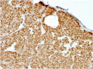 Immunohistochemical analysis of formalin-fixed, paraffin-embedded human parathyroid using Anti-Parathyroid Hormone Antibody [rPTH/911]