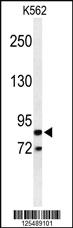 Anti-ZFYVE1 Rabbit Polyclonal Antibody