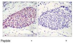 Anti-ATF2 Rabbit Polyclonal Antibody