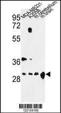 Anti-14-3-3 delta/zeta Rabbit Polyclonal Antibody (Biotin)