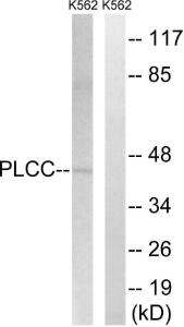 Anti-AGPAT3 Rabbit Polyclonal Antibody