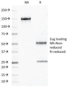 Anti-Chromogranin A antibody