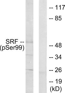 Western blot analysis of lysates from LOVO cells treated with Serum 10% 15' using Anti-SRF (phospho Ser99) Antibody. The right hand lane represents a negative control, where the antibody is blocked by the immunising peptide