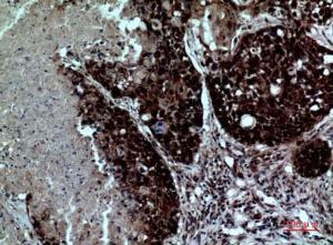 Immunohistochemical analysis of paraffin-embedded human lung using Anti-ITGAD Antibody