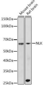 Western blot analysis of extracts of various cell lines, using Anti-NLK Antibody [ARC2441] (A305472) at 1:500 dilution. The secondary antibody was Goat Anti-Rabbit IgG H&L Antibody (HRP) at 1:10,000 dilution.