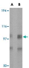 Anti-GRIK1 Rabbit Polyclonal Antibody