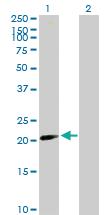 Anti-BATF2 Mouse Polyclonal Antibody