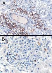 Antibody anti-SH3BP1 100 µg