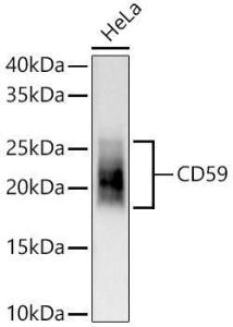 Western blot analysis of HeLa, using Anti-CD59 Antibody [ARC56723] (A309320) at 1:3,000 dilution The secondary antibody was Goat Anti-Rabbit IgG H&L Antibody (HRP) at 1:10,000 dilution Lysates/proteins were present at 25 µg per lane