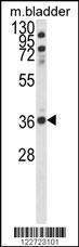 Anti-CCDC3 Rabbit Polyclonal Antibody (AP (Alkaline Phosphatase))