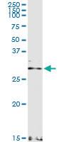 Anti-CACNG6 Rabbit Polyclonal Antibody