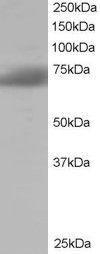 Antibody anti-SH3BP1 100 µg