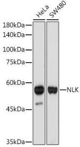 Western blot analysis of extracts of various cell lines, using Anti-NLK Antibody [ARC2441] (A305472) at 1:1,000 dilution. The secondary antibody was Goat Anti-Rabbit IgG H&L Antibody (HRP) at 1:10,000 dilution.