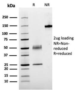 SDS-PAGE analysis of Anti-Parathyroid Hormone Antibody [rPTH/911] under non-reduced and reduced conditions; showing intact IgG and intact heavy and light chains, respectively. SDS-PAGE analysis confirms the integrity and purity of the antibody.