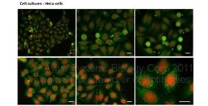 Anti-ZEB1 Rabbit Polyclonal Antibody