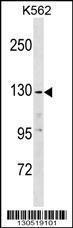 Anti-EGF Rabbit Polyclonal Antibody (PE (Phycoerythrin))