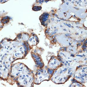 Immunohistochemistry analysis of paraffin-embedded human placenta using Anti-NLK Antibody [ARC2441] (A305472) at a dilution of 1:100 (40x lens). Perform microwave antigen retrieval with 10 mM Tris/EDTA buffer pH 9.0 before commencing with IHC staining protocol.