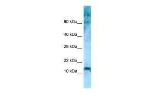 Anti-RPL36 Rabbit Polyclonal Antibody