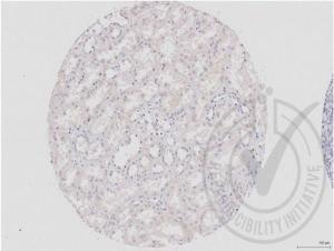 Anti-DVL1 Rabbit Polyclonal Antibody