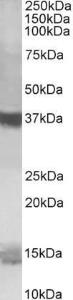 Anti-PFDN1 Antibody (A84008) (1µg/ml) staining of K562 lysate (35µg protein in RIPA buffer). Primary incubation was 1 hour. Detected by chemiluminescence.