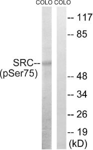 Western blot analysis of lysates from COLO205 cells treated with EGF 200ng/ml 30' using Anti-Src (phospho Ser75) Antibody. The right hand lane represents a negative control, where the antibody is blocked by the immunising peptide.