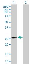 Anti-IDI1 Mouse Polyclonal Antibody