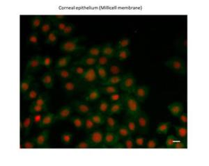 Anti-ZEB1 Rabbit Polyclonal Antibody